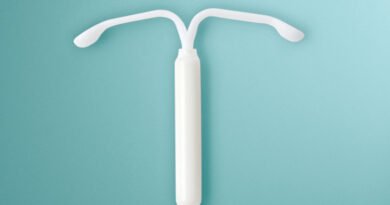 DIU hormonal é incorporado ao SUS como tratamento para endometriose