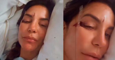 Ivete Sangalo relata mal-estar, desmaio e queda após virose e tranquiliza fãs nas redes sociais