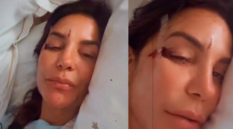 Ivete Sangalo relata mal-estar, desmaio e queda após virose e tranquiliza fãs nas redes sociais