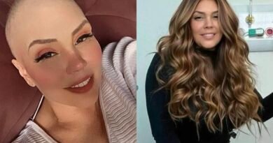 Simony revela que vendeu bens para custear tratamento contra câncer: “Vendi tudo o que foi preciso”
