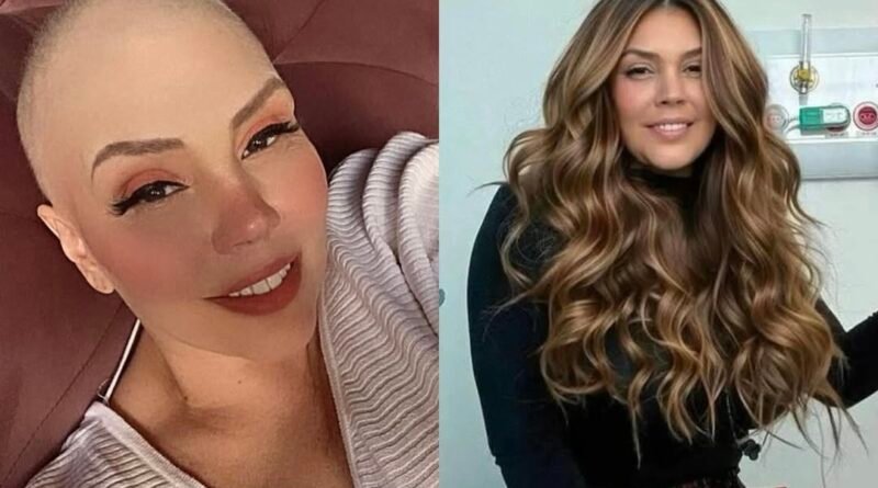 Simony revela que vendeu bens para custear tratamento contra câncer: “Vendi tudo o que foi preciso”