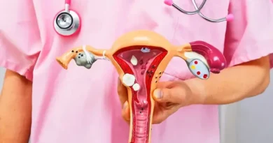 Planos de saúde terão de cobrir DIU hormonal para casos específicos de endometriose