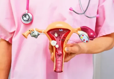 Planos de saúde terão de cobrir DIU hormonal para casos específicos de endometriose