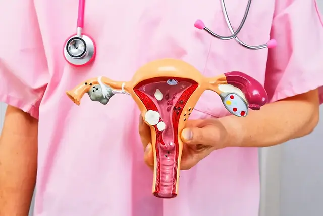 Planos de saúde terão de cobrir DIU hormonal para casos específicos de endometriose